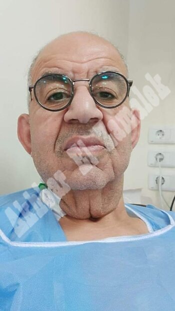 ترند مصر اليوم | وفاة اليوتيوبر القزم عزيز السعودي .. تفاصيل الحالة الصحية للفنان محمد التاجي