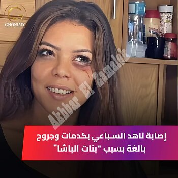 اخبار الزمالك - بشرة خير من عالمة فلك 5 أبراج ينتظرهم السعد فى شهر أكتوبر ورسالة تحذير..  إصابة ناهد السباعي .. سلمى ابو ضيف تكشف عن انتظار مولود جديد 